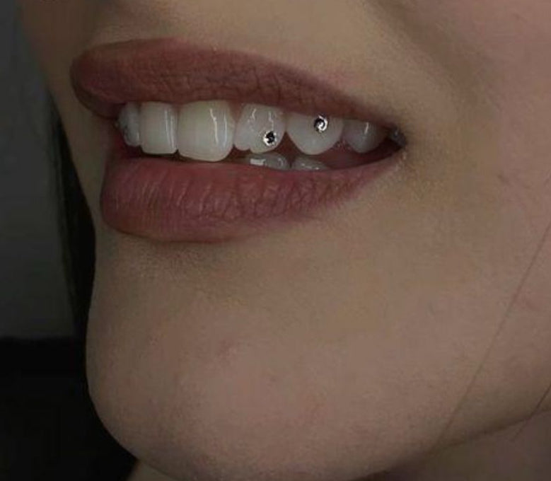 Perfectionnement Combiné Strass & Blanchiment Dentaire